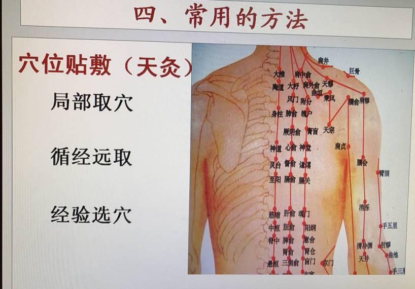 管家一肖100%期期中奖，详细解答、专家解答解释落实